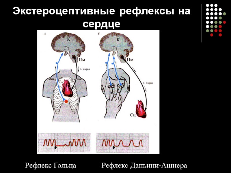 Экстероцептивные рефлексы на сердце Рефлекс Гольца Рефлекс Даньини-Ашнера